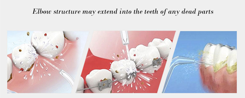 70ml Oral Dental Implement Flosser Tooth Cleaner Water Jet Irrigator
