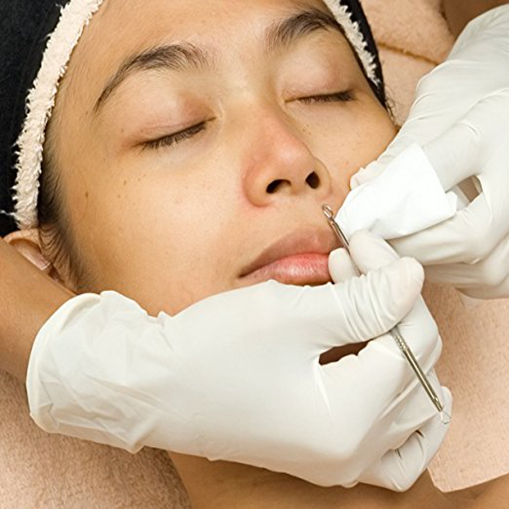 TODO Acne Needle Five Blackhead Facial Spot Pimples Comedone Acne Removing Kit