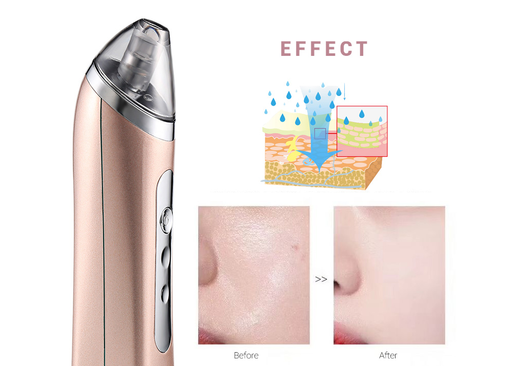 Electric Blackhead Remover Pore Cleaner Facial Beauty Instrument