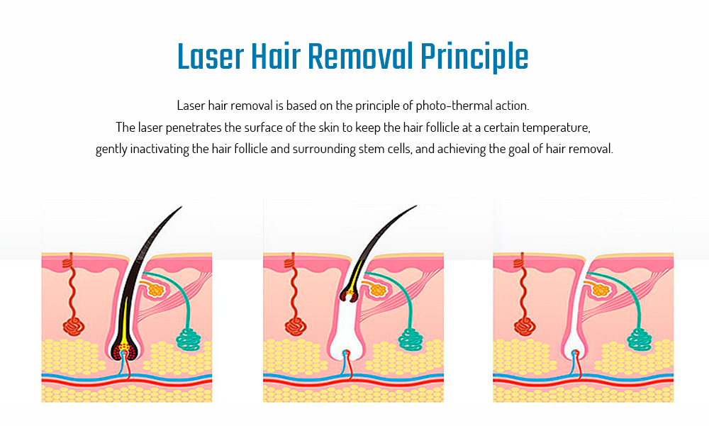 MY - 006 IPL Photon Pulse Hair Removal Electric Lady Epilator